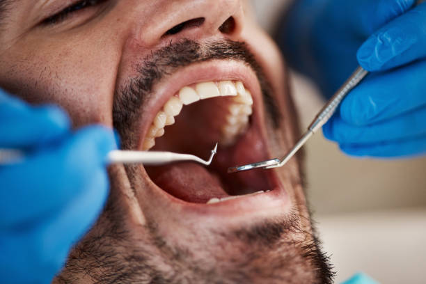 Emergency Dental Services in Cameron Park, TX